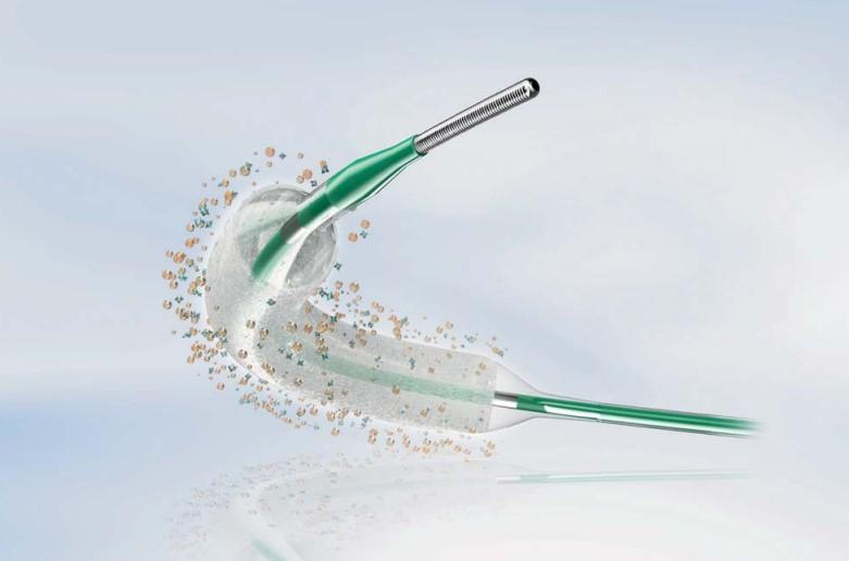 Балонний катетер з покриттям SeQuent Please Neo 3,0х30мм